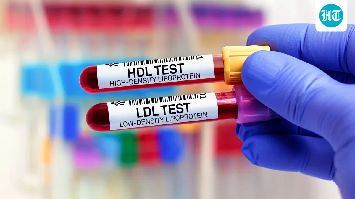 Why is your cholesterol high even though you are slim? A cardiologist explains 6 possible causes beyond weight gain