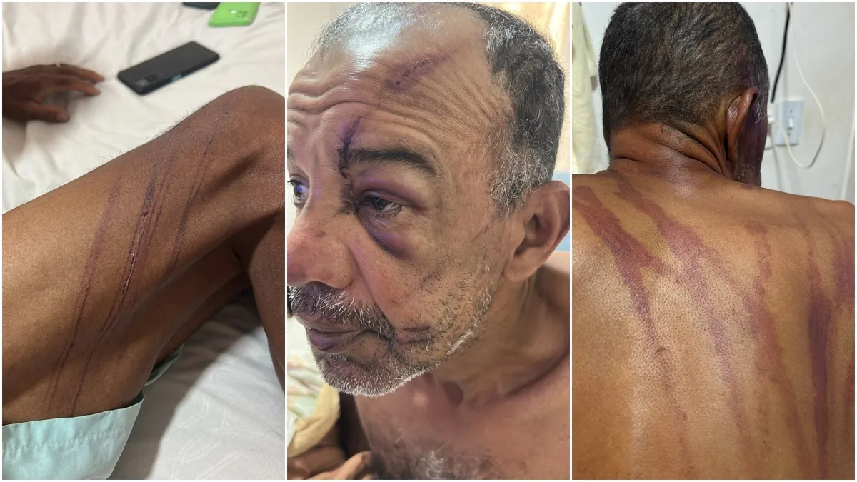 ‘Simplesmente por ele ser negro, ser pobre’, diz filha de homem que denunciou agressões de seguranças em barraca de praia em Fortaleza