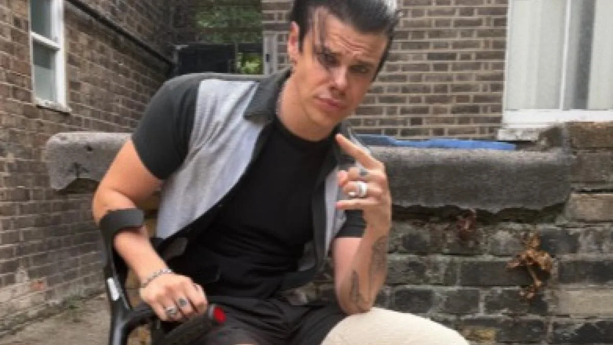 Yungblud vows to press on with European festival dates after breaking his leg in motorcycle crash
