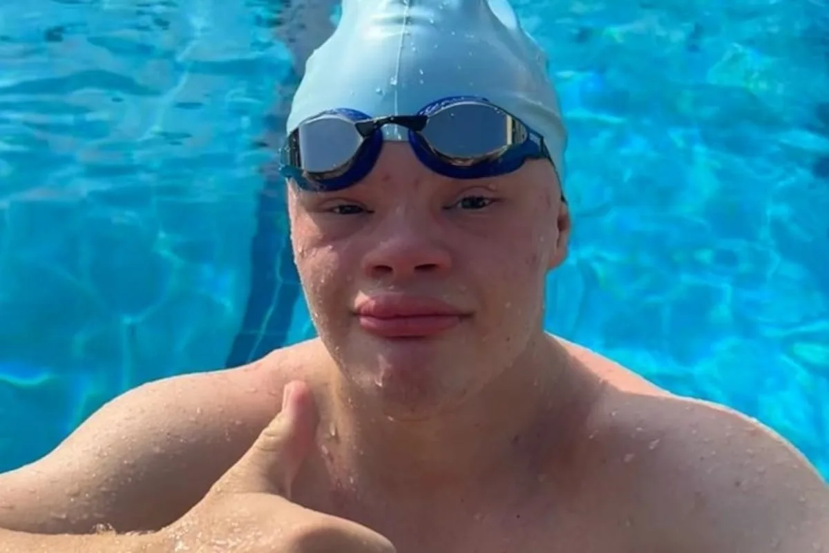 Swimmer with Down syndrome appeals for funding to compete at world championships