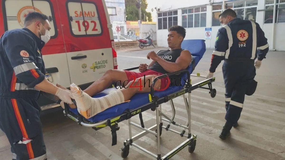 Acidente entre carro e moto deixa casal com fraturas na BR-364, em Senador Guiomard