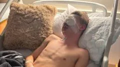 Teen blinded by firework wants ban on public sales