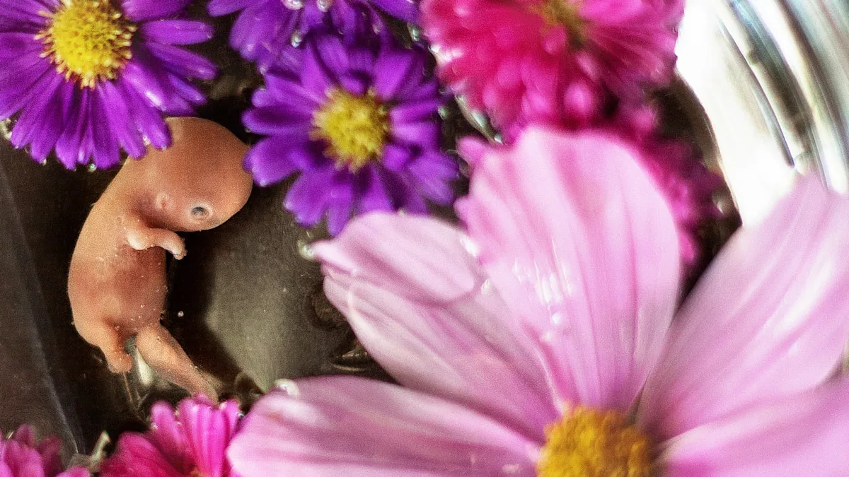 Heute ist Tag des Sternenkindes - Dann hat Dein Herz plötzlich aufgehört zu schlagen
