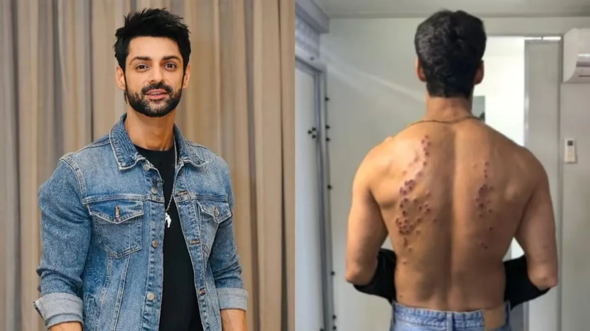 'Went Numb': After Gaurav Khanna, Karan Wahi Reacts To Khatron Ke Khiladi 15's Painful Rubber Bullet Task