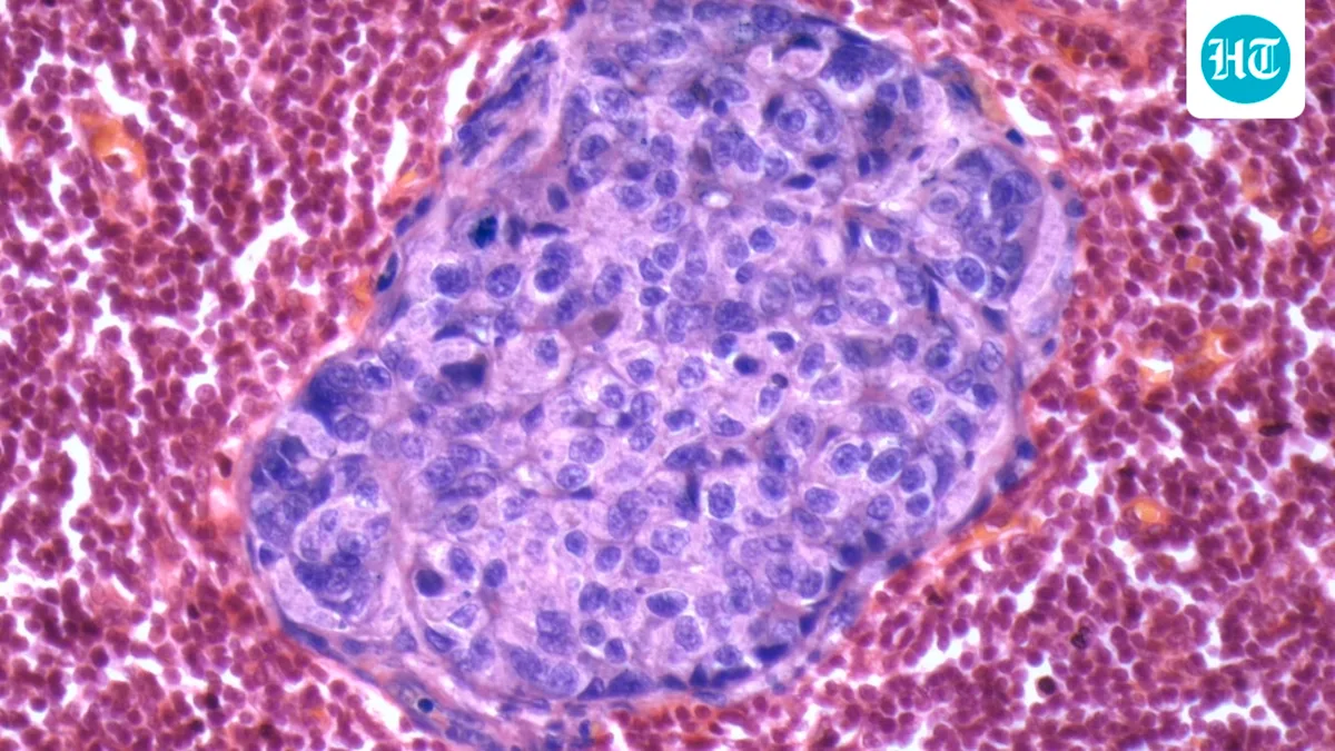 Big pharma is pouring billions into a new class of ‘protein degrader’ drugs