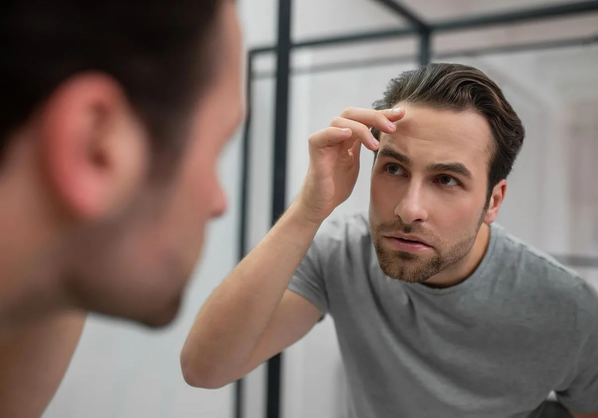 ¿Tener entradas es sinónimo de sufrir alopecia en el futuro?