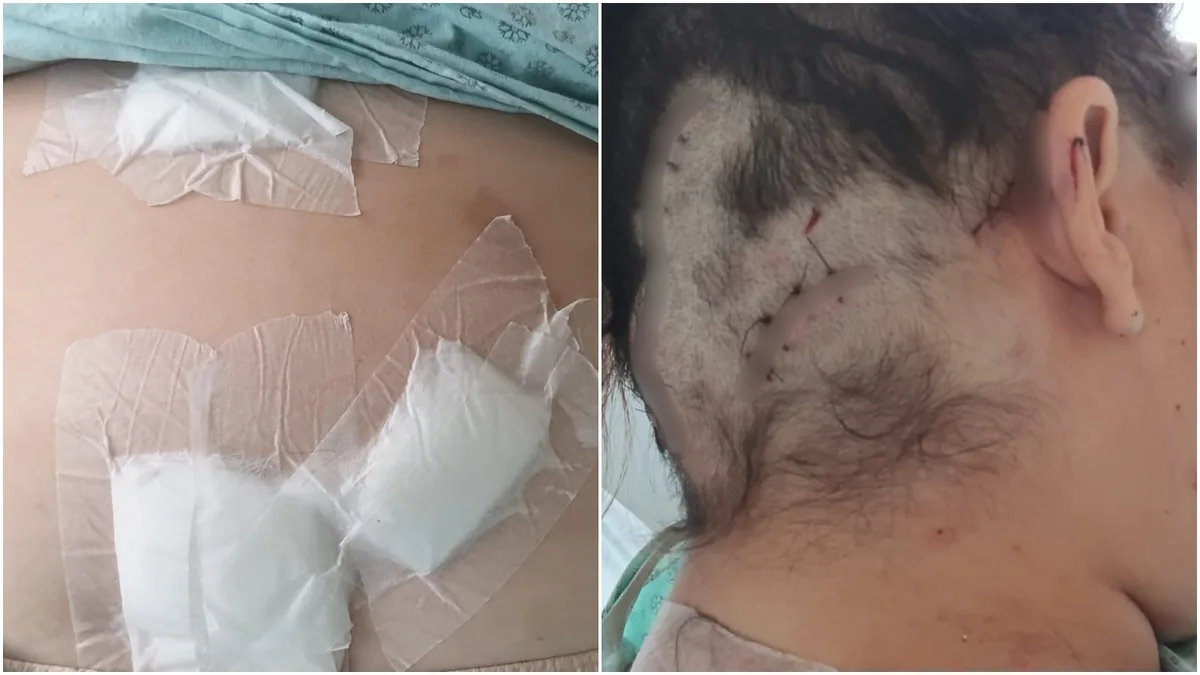 Mulher é mantida em cárcere, torturada e atingida pelo ex com 12 facadas: 'fingi que estava morta'