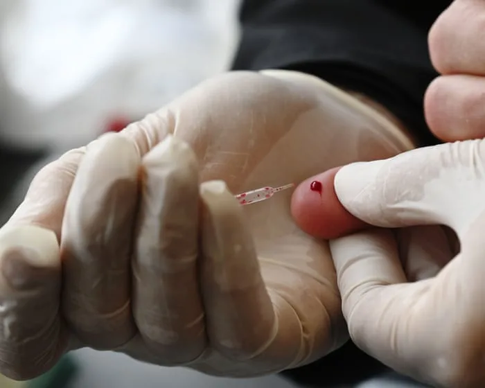 Free cholesterol tests on the NHS are great – but here’s the five-point health MOT I’d really like to see | Devi Sridhar