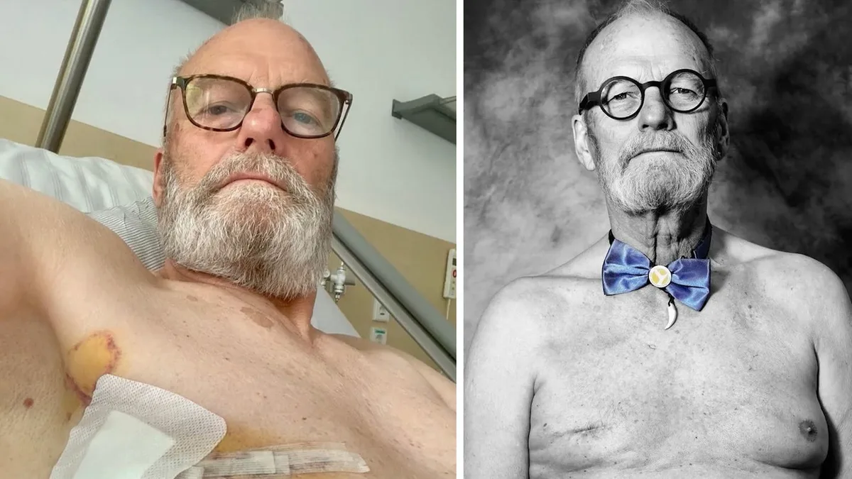 Tabuthema in der Medizin: Brustkrebs als Mann – für Olaf Michel begann es mit einem Jucken