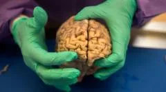 Brain disease in ex-NFL players 'higher than previously shown'