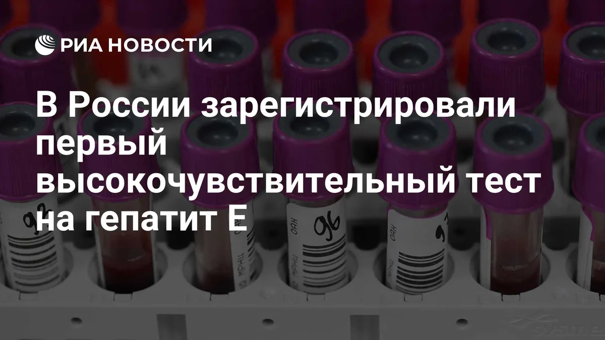 В России зарегистрировали первый высокочувствительный тест на гепатит E