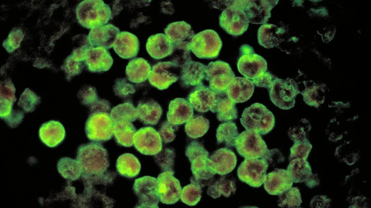 ICMR study identifies well water as major risk factor for amoebic meningoencephalitis in Keralam