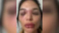 Vídeo: Veja momento em que empresário agride a esposa em SP
