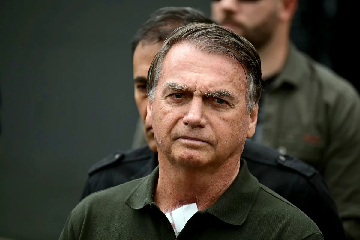 Bolsonaro pede autorização para deixar prisão domiciliar e ir ao dentista