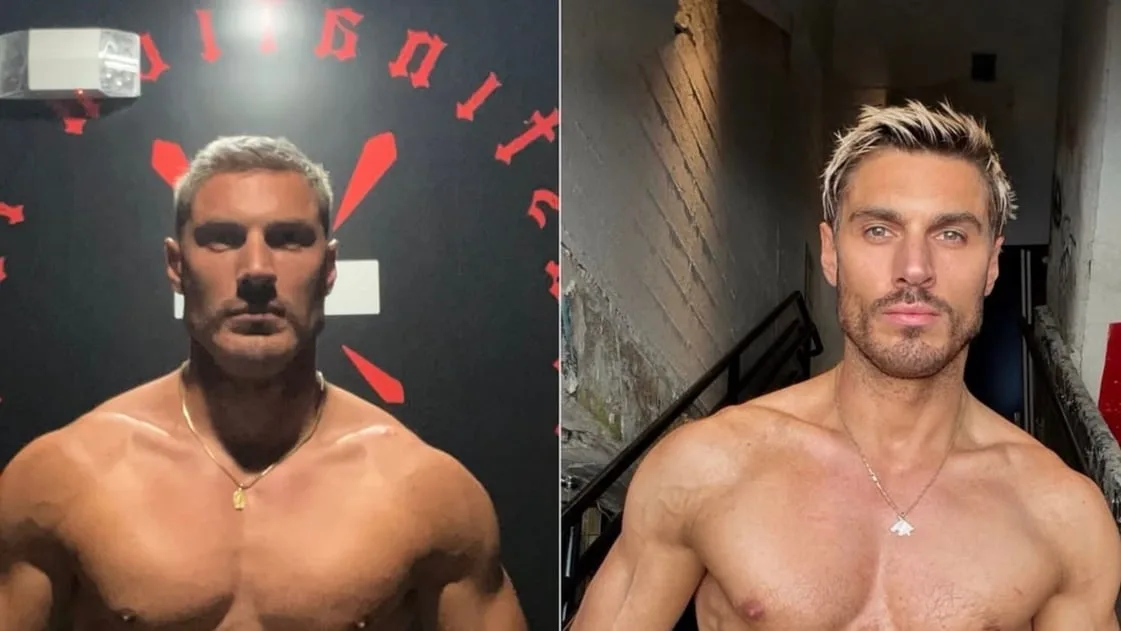 Reality Contestant Shares Shocking 2-Week Weight Loss Photos
