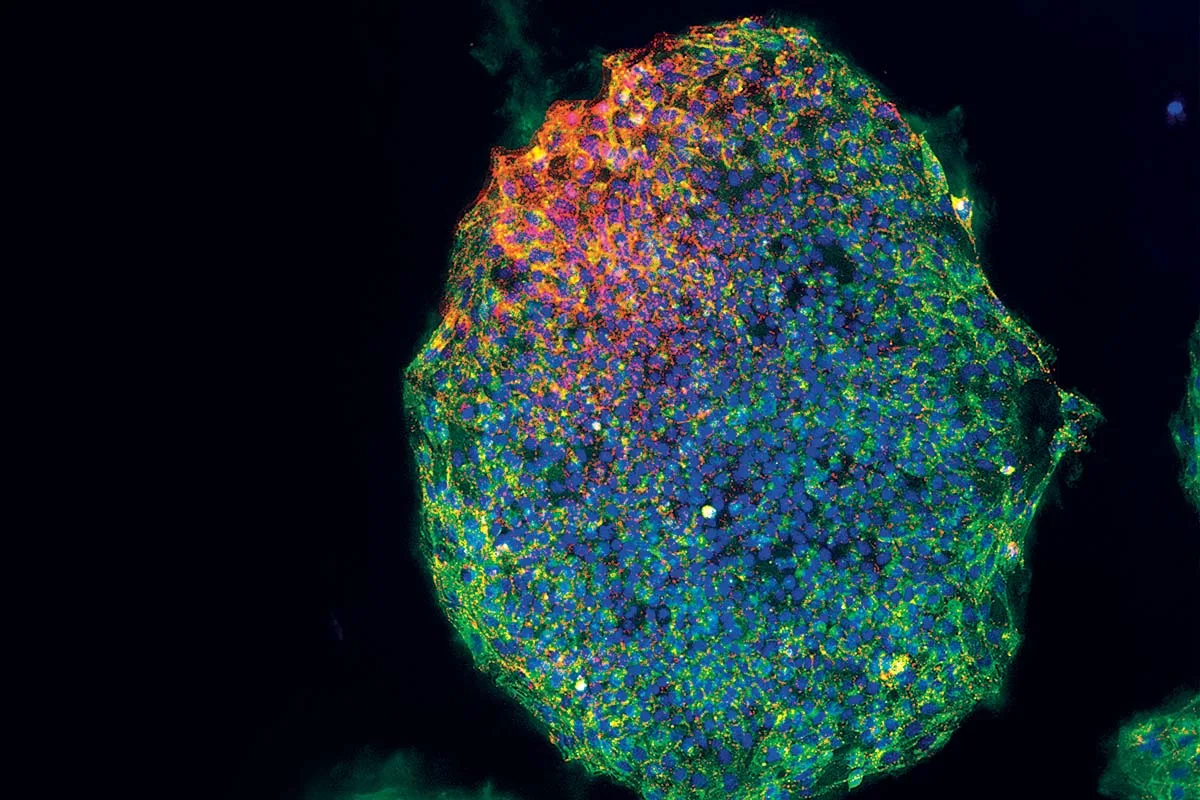 若返りの科学 老化を逆戻りさせる方法はあるのか？