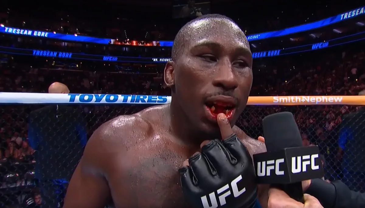 UFC 330: Tresean Gore vence Vicente Luque, mas perde dentes na luta e fica "banguela"