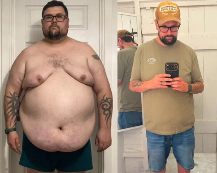 63kg 뺀 남성, 딸 위해 ‘한 가지’ 실천해 감량 성공… 뭐지?