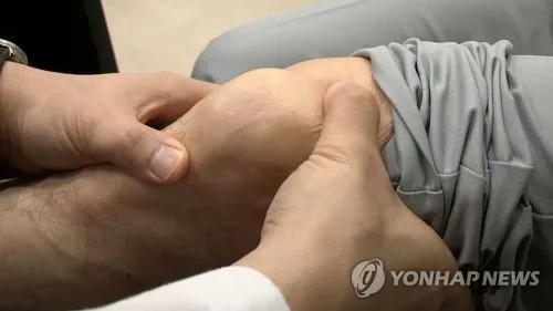 무릎 인공관절 10개 중 8개 수입산…발목·팔꿈치는 전량