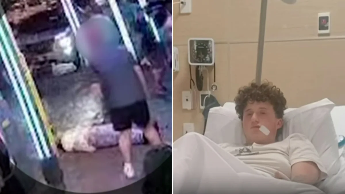 One coward punch changed Beau's life forever. Now he wants his attacker jailed