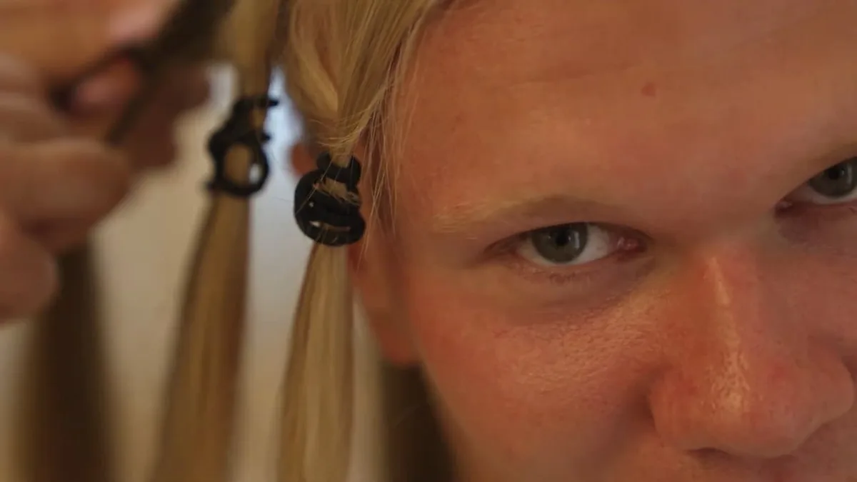 Ex-BVB-Star völlig verändert - Die HAARland-Transformation im Video