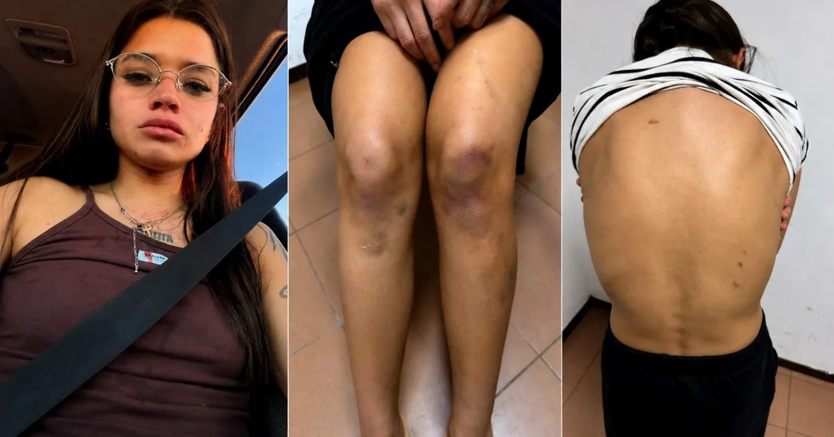 Qué dice el informe sobre las lesiones de Victoria Cantero, la joven detenida por matar a su novio en Chaco