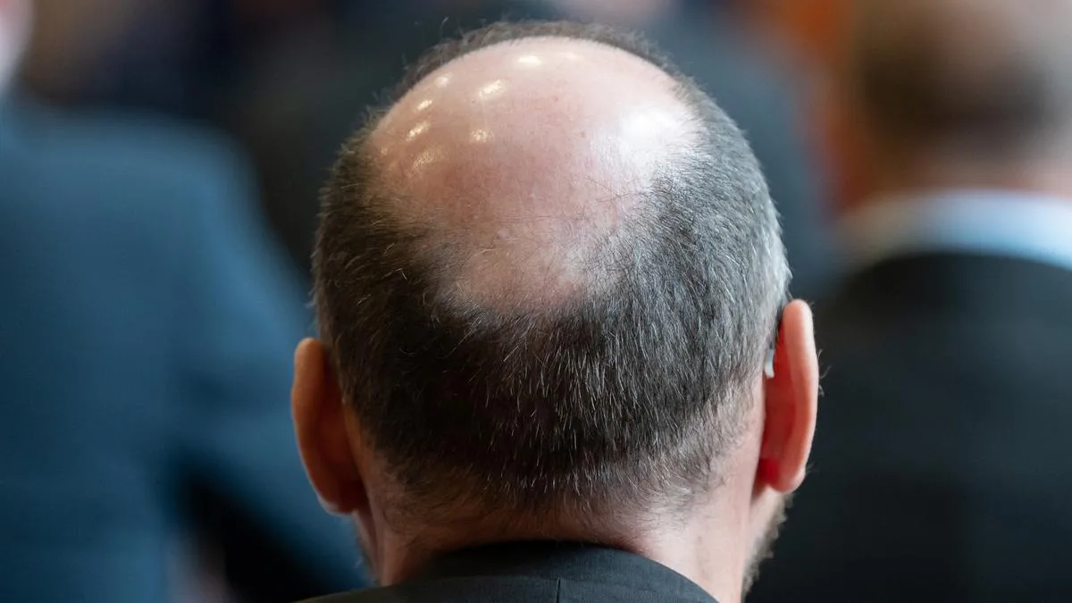 Hair loss jabs teased by Wegovy makers