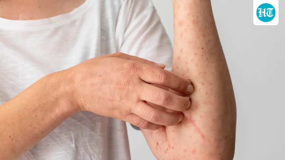 Got a red, itchy rash this monsoon? Dermatologist explains why your skin reacts during the humid season